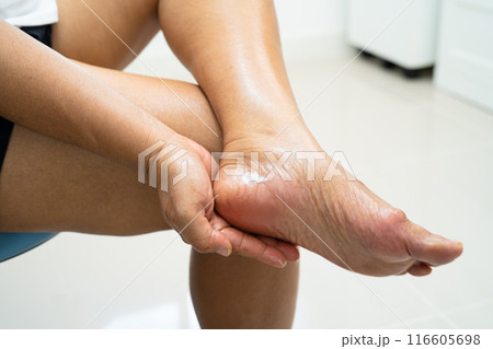 Asian woman care feet with cracked and dry heel skin cream at home. Asian woman care feet with cracked and dry heel skin cream at home. 116605698