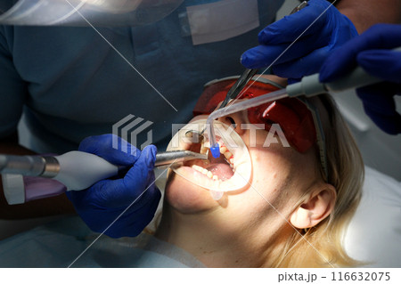 female dentist examining young girl patient's teeth at dental clinic. Doctor probing teeth with dental instrument using an explorer look for cavities treatment and checking problems with filling female dentist examining young girl patient's teeth at dental clinic. Doctor probing teeth with dental instrument using an explorer look for cavities treatment and checking problems with filling 116632075