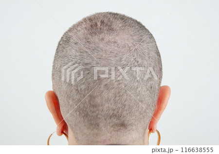 A Testament to Strength: The Rear View of a Woman's Shaved Head Post-Chemotherapy, Celebrating Her Unyielding Spirit and Courage. 116638555
