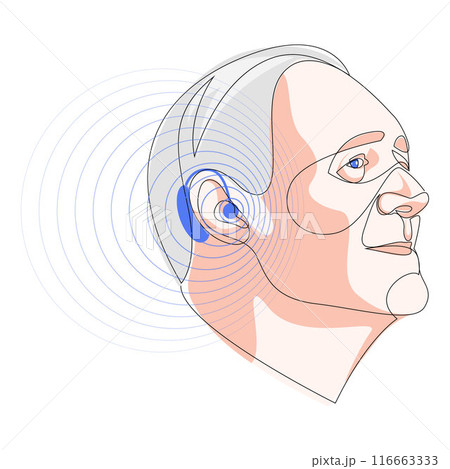 Senior man wearing hearing aid and hears well. Otolaryngology treatment concept. One line drawing of healthcare device, medicine technology. Vector illustration. 116663333