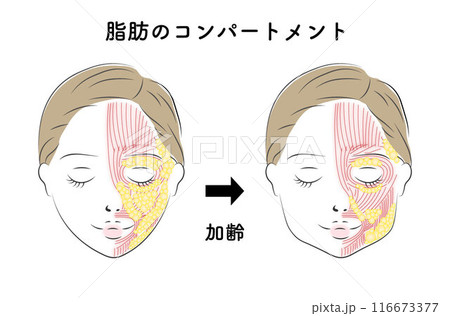 顔の脂肪の年齢変化、顔のたるみに悩む女性イラスト 顔の脂肪の年齢変化、顔のたるみに悩む女性イラスト 116673377