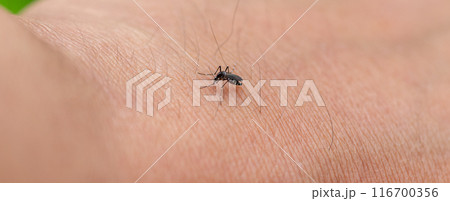 蚊に刺された人 116700356