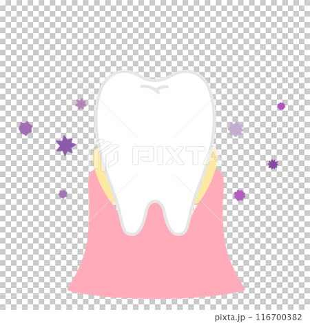 歯石とばい菌で不衛生な歯のイラスト 116700382