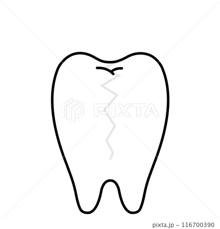 縦にヒビが入った歯1本のイラスト 縦にヒビが入った歯1本のイラスト 116700390