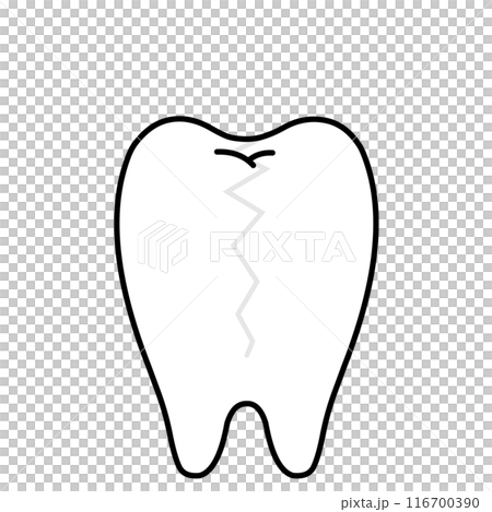 縦にヒビが入った歯1本のイラスト 縦にヒビが入った歯1本のイラスト 116700390