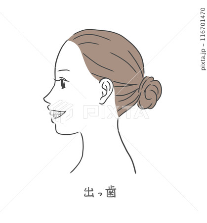歯が出た横顔の女性のイラスト 歯が出た横顔の女性のイラスト 116701470