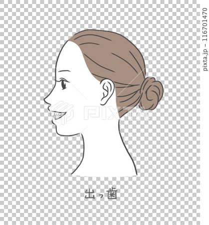 歯が出た横顔の女性のイラスト 歯が出た横顔の女性のイラスト 116701470