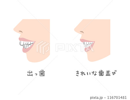 横から見た女性の歯並びのイラスト 横から見た女性の歯並びのイラスト 116701481