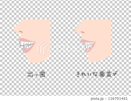 横から見た女性の歯並びのイラスト 横から見た女性の歯並びのイラスト 116701481
