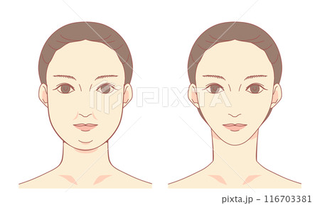 二重あごと小顔のイラスト 二重あごと小顔のイラスト 116703381