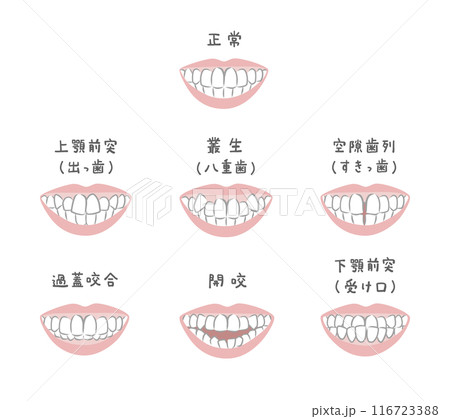 様々な歯並びの女性のイラストセット 様々な歯並びの女性のイラストセット 116723388