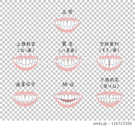 様々な歯並びの女性のイラストセット 様々な歯並びの女性のイラストセット 116723388