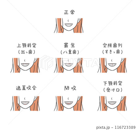 様々な歯並びの女性のイラストセット 様々な歯並びの女性のイラストセット 116723389