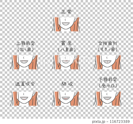 具有各種牙齒排列的女性插圖集 116723389