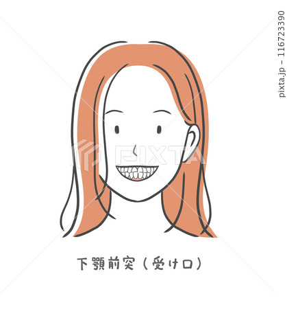 受け口の歯並びが悪い女性のイラスト素材 116723390