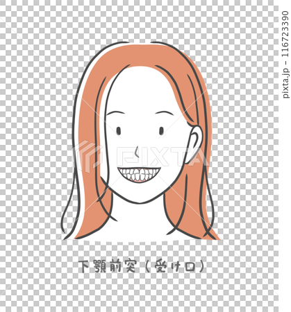 受け口の歯並びが悪い女性のイラスト素材 116723390