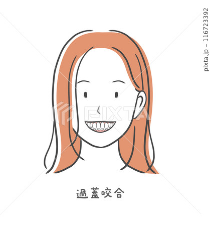過蓋咬合の歯並びが悪い女性のイラスト素材 過蓋咬合の歯並びが悪い女性のイラスト素材 116723392
