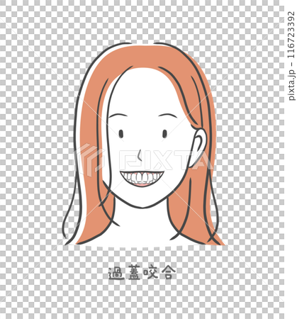過蓋咬合の歯並びが悪い女性のイラスト素材 過蓋咬合の歯並びが悪い女性のイラスト素材 116723392