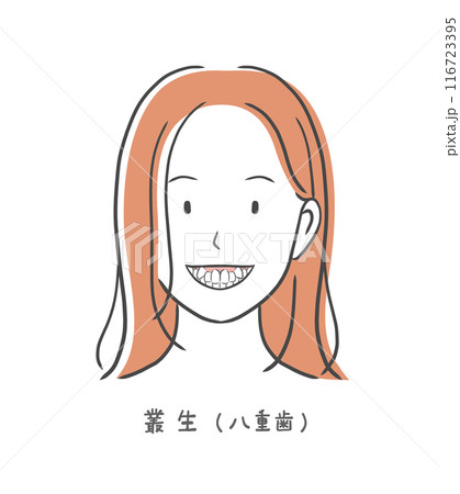 八重歯の歯並びが悪い女性のイラスト素材 八重歯の歯並びが悪い女性のイラスト素材 116723395