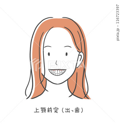 出っ歯の歯並びが悪い女性のイラスト素材 116723397