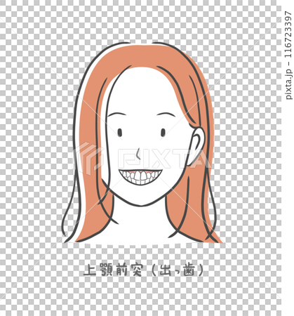 出っ歯の歯並びが悪い女性のイラスト素材 116723397