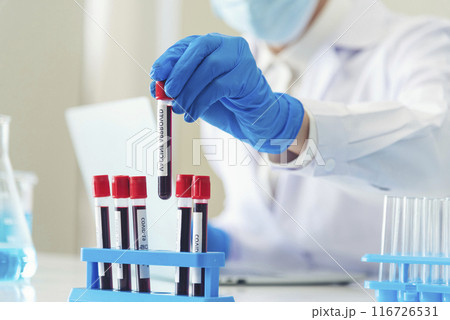 Close up Scientist man hands holding sample blood test tube science laboratory. Doctor clinic healthcare technician lab testing blood sample diagnosis. Crop man scientist hands testing medical lab 116726531