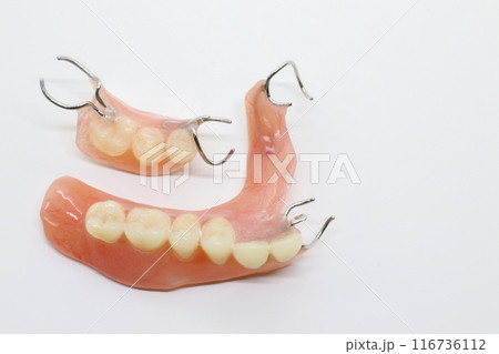 二つの部分入れ歯_02 116736112