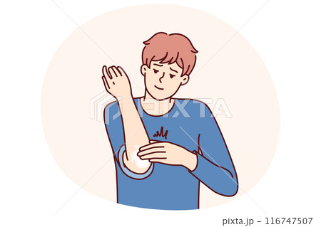 Man smears elbow with healing dermatological ointment after bruise or skin problems and acne 116747507