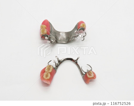 Upper and Lower Partial Denture 116752526