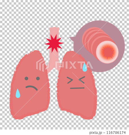 Bronchi and lungs, asthma disease illustration character Bronchi and lungs, asthma disease illustration character 116786174