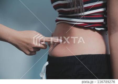 Women body fat belly. Obese woman hand holding excessive belly fat. diet lifestyle concept to reduce belly and shape up healthy stomach muscle. 116789276