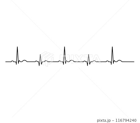 電気的交互脈 116794240