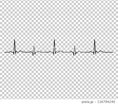 電気的交互脈 116794240