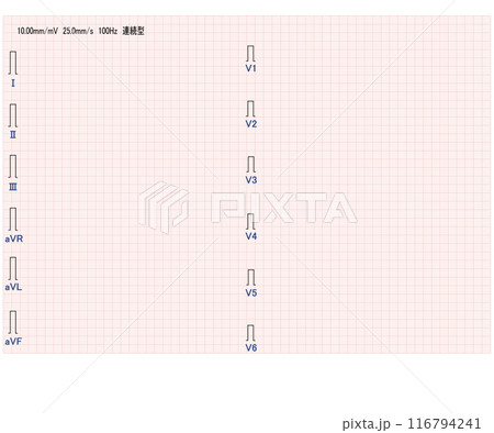 十二誘導心電図記録紙 十二誘導心電図記録紙 116794241