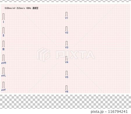 十二誘導心電図記録紙 十二誘導心電図記録紙 116794241