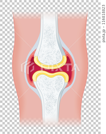 膝関節 膝関節 116818823
