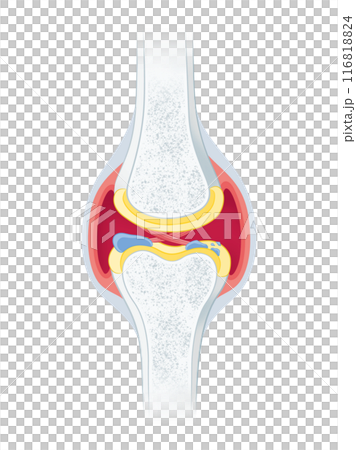 Osteoarthritis of the knee 116818824