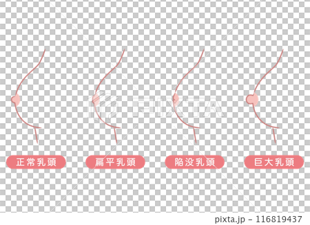 乳頭形狀 乳頭類型 類型 乳頭形狀 乳頭類型 類型 116819437