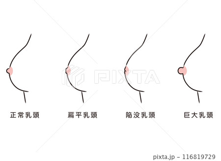 乳頭のかたち　乳首のタイプ　種類 116819729