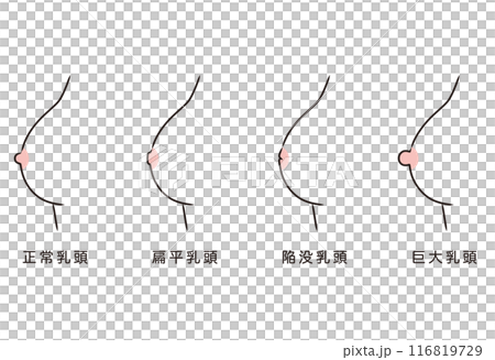 Nipple shape, nipple type, variety 116819729