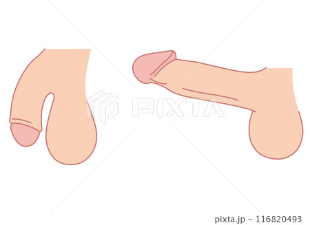 男性生殖器 医療 男性生殖器 医療 116820493