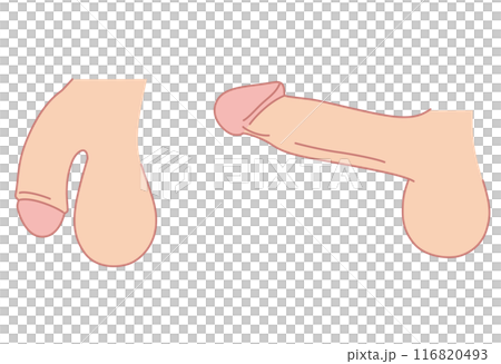 男性生殖器 医療 男性生殖器 医療 116820493