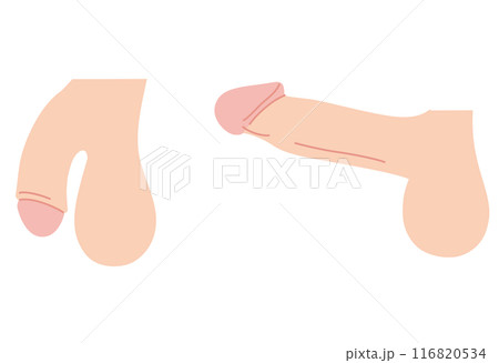 男性生殖器　医療 116820534