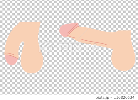 男性生殖器　医療 116820534