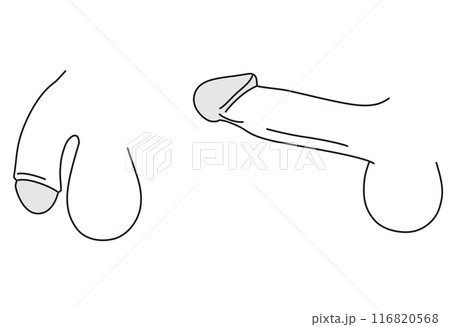 男性生殖器 医療 男性生殖器 医療 116820568