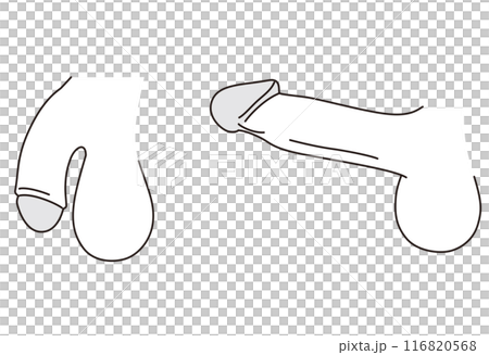 男性生殖器 医療 男性生殖器 医療 116820568