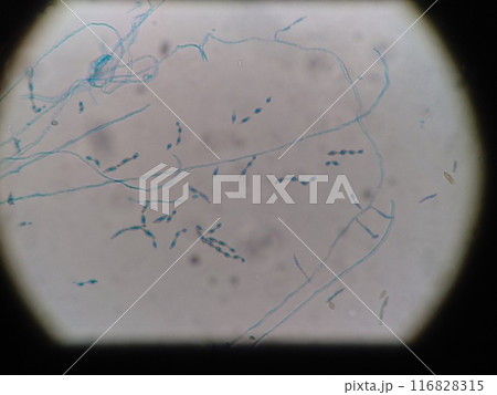 きれいに並んだアルテルナリアの胞子 きれいに並んだアルテルナリアの胞子 116828315