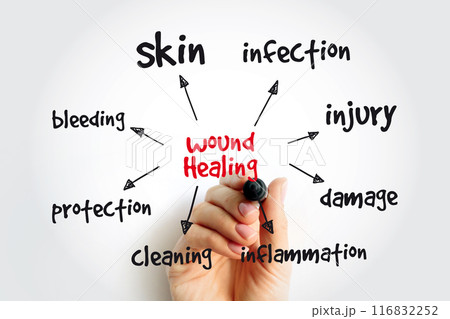 Wound Healing mind map with marker, health concept for presentations and reports 116832252