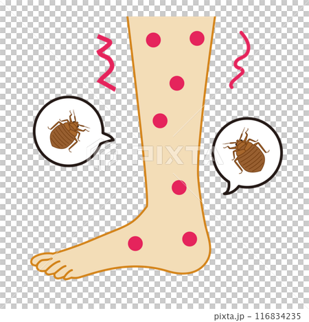 Illustration of itchy feet bitten by bedbugs 116834235