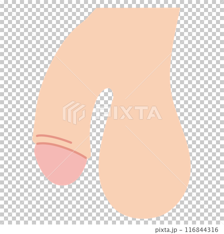 男性生殖器 医療 男性生殖器 医療 116844316